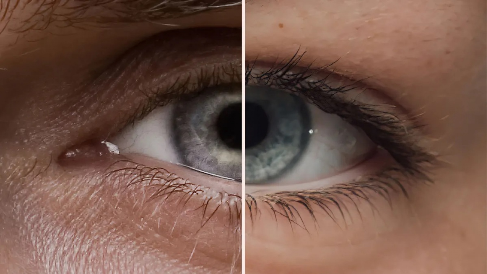 rus: Два ока різних людей, співставлені разом в одне, з паралельною білою розділовою лінією посередині. 